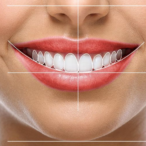 diseno_sonrisa.jpg